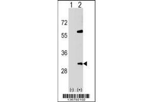 Western blot analysis of SNF8 using rabbit polyclonal SNF8 Antibody using 293 cell lysates (2 ug/lane) either nontransfected (Lane 1) or transiently transfected (Lane 2) with the SNF8 gene. (SNF8 Antikörper  (N-Term))