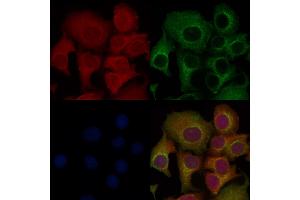 ABIN6261700 and ABIN6276598 staining Hela cells by IF/ICC.