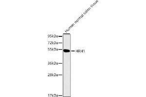 Western blot analysis of extracts of Human normal colon tissue, using HRH1 antibody (ABIN1680348, ABIN3015480, ABIN3015481 and ABIN7101436).