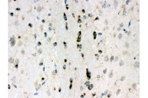 Anti- Lumican Picoband antibody, IHC(P) IHC(P): Mouse Brain Tissue (LUM Antikörper  (AA 68-338))