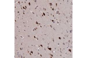 Immunohistochemical staining of human cerebral cortex with ADO polyclonal antibody  shows strong cytoplasmic positivity in neuronal cells. (ADO Antikörper)