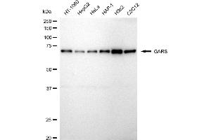 anti-Glycyl-tRNA Synthetase (GARS) antibody