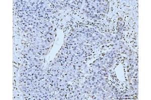 IHC analysis of KIFC1 using anti-KIFC1 antibody (ABIN7599523). (KIFC1 Antikörper  (AA 1-673))