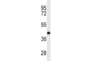 MCL1 antibody western blot analysis in Y79 lysate. (MCL-1 Antikörper  (AA 217-245))