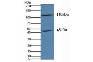 Detection of KIF18A in Human Hela Cells using Polyclonal Antibody to Kinesin Family, Member 18A (KIF18A) (KIF18A Antikörper  (AA 1-453))