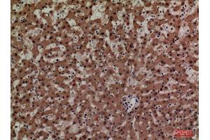 Immunohistochemistry (IHC) analysis of paraffin-embedded Human Liver, antibody was diluted at 1:100. (Adrenomedullin Antikörper  (Internal Region))