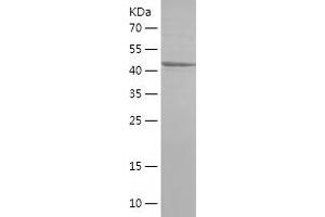 Western Blotting (WB) image for YME1-Like 1 (YME1L1) (AA 502-720) protein (His-IF2DI Tag) (ABIN7125759) (YME1L1 Protein (AA 502-720) (His-IF2DI Tag))