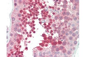 Anti-YBX3 / CSDA antibody IHC staining of human testis. (CSDA Antikörper  (AA 290-339))
