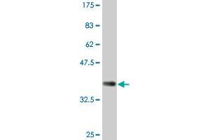 Western Blot detection against Immunogen (37. (RBPJ Antikörper  (AA 3-109))