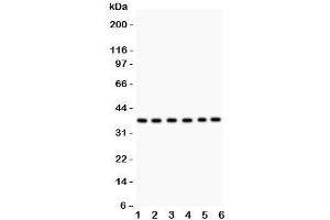 Western blot testing of Rad51 antibody and Lane 1:  22RV1;  2: SW620;  3: PANC;  4: U87;  5: CEM;  6: MM231. (RAD51 Antikörper  (AA 1-258))