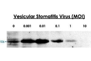 24-hour post infection immunoblots of whole cell lysates from primary murine microglia cells (2x10 6 ) untreated (0) or exposed to vesicular stomatitis virus at a range of viral particle/cell ratios. (DDX58 Antikörper  (C-Term))
