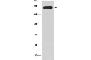 Western blot analysis of MYH11 expression in Human testis lysate.
