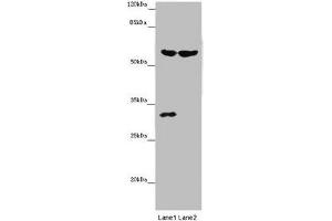 Western blot All lanes: TERF2 antibody at 14 μg/mL Lane 1: Mouse thymus tissue Lane 2: MCF-7 whole cell lysate Secondary Goat polyclonal to rabbit IgG at 1/10000 dilution Predicted band size: 60, 33 kDa Observed band size: 60, 31 kDa (TRF2 Antikörper  (AA 78-238))