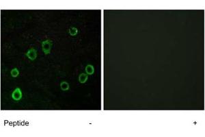 Immunofluorescence analysis of LoVo cells, using ADORA2A polyclonal antibody . (Adenosine A2a Receptor Antikörper)