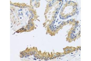 Immunohistochemistry of paraffin-embedded Human prostate using ARL6 Polyclonal Antibody at dilution of 1:100 (40x lens). (ARL6 Antikörper)