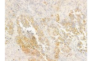 anti-Ectonucleoside Triphosphate diphosphohydrolase 2 (ENTPD2) (N-Term) antibody