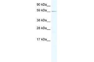Western Blot showing RBM14 antibody used at a concentration of 1-2 ug/ml to detect its target protein. (RBM14 Antikörper  (N-Term))