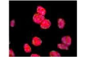 Anti-ATM Monoclonal Antibody - Immunofluorescence Anti ATM Antibody showing overlay of anti-ATM pS1981 staining. (ATM Antikörper  (pSer1981) (HRP))