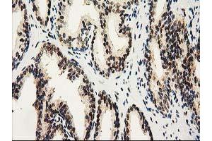 Image no. 5 for anti-Nonhomologous End-Joining Factor 1 (NHEJ1) antibody (ABIN1499729) (NHEJ1 Antikörper)