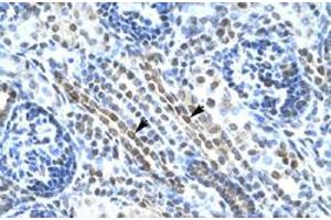 Immunohistochemical staining (Formalin-fixed paraffin-embedded sections) of human kidney with ANKRD11 polyclonal antibody  at 4-8 ug/mL working concentration. (ANKRD11 Antikörper  (N-Term))