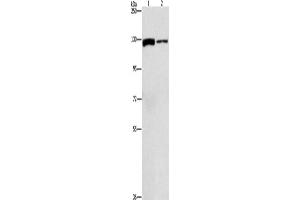 Western Blotting (WB) image for anti-ATP Citrate Lyase (ACLY) antibody (ABIN2429587) (ACLY Antikörper)