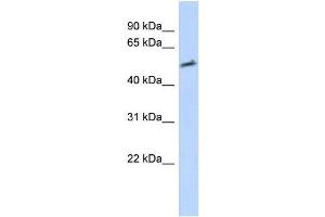 Transfected 293T; WB Suggested Anti-IKZF2 Antibody Titration: 0. (IKZF2 Antikörper)