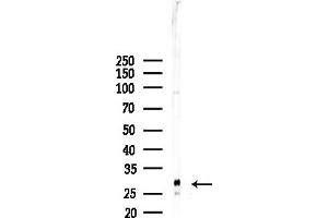 anti-TM2 Domain Containing 1 (TM2D1) (Internal Region) antibody