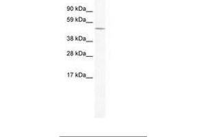 Image no. 1 for anti-Ceramide Synthase 4 (CERS4) (AA 49-98) antibody (ABIN202416) (LASS4 Antikörper  (AA 49-98))