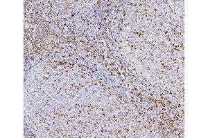 IHC analysis of CD43 using anti-CD43 antibody (ABIN7601042). (CD43 Antikörper  (AA 272-400))