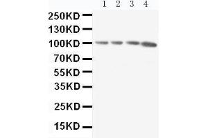 Western Blotting (WB) image for anti-Amyloid beta (A4) Precursor Protein-Binding, Family B, Member 1 Interacting Protein (APBB1IP) (AA 647-666), (C-Term) antibody (ABIN3044029)