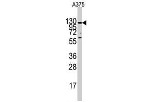 Western blot analysis of IDE polyclonal antibody  in A-375 cell line lysates (35 ug/lane). (IDE Antikörper  (Internal Region))