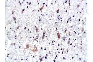 Formalin-fixed and paraffin embedded: rat brain tissue labeled with Anti-PKB Polyclonal Antibody, Unconjugated 1:200 followed by conjugation to the secondary antibody and DAB staining (AKT1/3 (AA 401-479) Antikörper)
