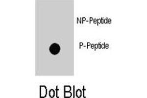 Dot blot analysis of ZBTB16 (phospho Y334) polyclonal antibody  on nitrocellulose membrane. (ZBTB16 Antikörper  (pTyr334))