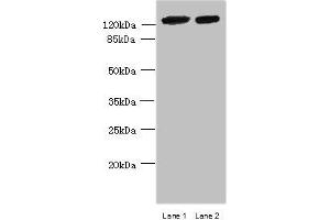 Western blot All lanes: MCM9 antibody at 0. (MCM9 Antikörper  (AA 1-391))