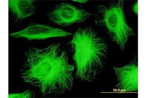 Immunofluorescence (IF) image for anti-Tubulin, beta 2A (TUBB2A) (AA 1-445) antibody (ABIN521149)