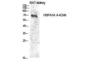 Western Blot (WB) analysis of Rat Kidney cells using Acetyl-HSP70 (K246) Polyclonal Antibody.