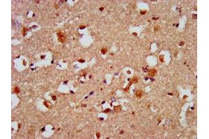 IHC image of ABIN7146458 diluted at 1:500 and staining in paraffin-embedded human brain tissue performed on a Leica BondTM system. (Calcyphosine 2 Antikörper  (AA 191-274))