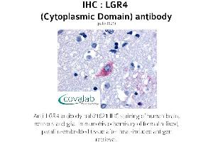 Image no. 1 for anti-Leucine-Rich Repeat Containing G Protein-Coupled Receptor 4 (LGR4) (2nd Cytoplasmic Domain) antibody (ABIN1736432) (LGR4 Antikörper  (2nd Cytoplasmic Domain))