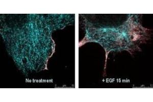 Immunofluorescence (IF) image for anti-V-Akt Murine Thymoma Viral Oncogene Homolog 1 (AKT1) (Ser473) antibody (ABIN400784) (AKT1 Antikörper  (Ser473))