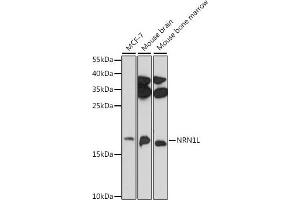 Western blot analysis of extracts of various cell lines, using NRN1L antibody (ABIN7268861) at 1:1000 dilution. (Neuritin 1-Like Antikörper)