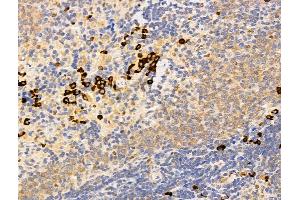ABIN7094787 and ABIN7098838 at 1/100 staining Rat spleen tissue by IHC-P. (DCP2 Antikörper  (Internal Region))