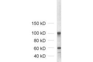 Western Blotting (WB) image for anti-Neuroligin 1/2/3/4 (NLGN1/2/3/4) (AA 1-695) antibody (ABIN1742285)