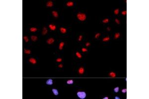 Immunofluorescence analysis of MCF-7 cells using Phospho-CDK1(T161) Polyclonal Antibody (CDK1 Antikörper  (pThr161))
