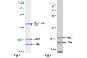 Kinase Activity Assay (KAA) image for Feline Sarcoma Oncogene (FES) (AA 1-822) protein (GST tag) (ABIN1353967) (FES Protein (AA 1-822) (GST tag))