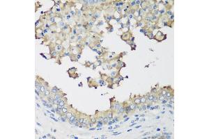 Immunohistochemistry of paraffin-embedded human prostate using NEDD4L antibody. (NEDD4-2 Antikörper)
