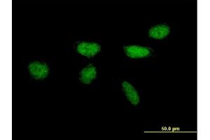 Immunofluorescence of purified MaxPab antibody to XPA on HeLa cell.