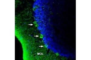 Expression of GPR40/FFAR1 in rat brainImmunohistochemical staining of rat brain sections using Anti-GPR40/FFAR1 (extracellular) Antibody (ABIN7043137, ABIN7044279 and ABIN7044280). (Free Fatty Acid Receptor 1 (FFAR1) Peptid)