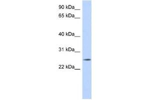 Western Blotting (WB) image for anti-Na+/K+ Transporting ATPase Interacting 4 (NKAIN4) antibody (ABIN2459631) (NKAIN4 Antikörper)
