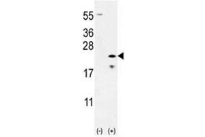 Western blot analysis of Bax antibody and 293 cell lysate (2 ug/lane) either nontransfected (Lane 1) or transiently transfected (2) with the Bax gene. (BAX Antikörper  (AA 41-76))