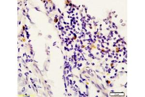 Formalin-fixed and paraffin embedded rat uterus labeled with Anti-STAT6 Polyclonal Antibody, Unconjugated  at 1:200 followed by conjugation to the secondary antibody and DAB staining. (STAT6 Antikörper  (AA 601-700))